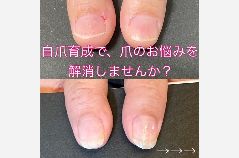 F52D5683-D9A5-40F3-A8B9-B9145EC3A5B0